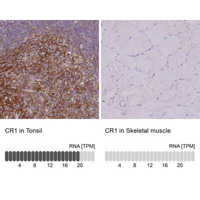 Immunohistochemistry-Paraffin: CD35 Antibody [NBP2-13870]