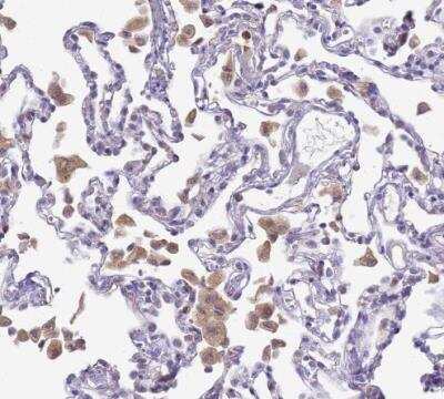 Immunohistochemistry-Paraffin: CD35 Antibody [NBP2-13870]