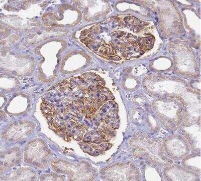 Immunohistochemistry-Paraffin: CD35 Antibody [NBP2-13870]