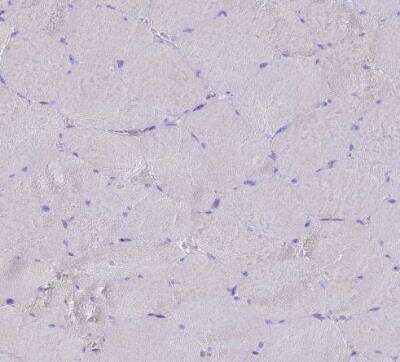 Immunohistochemistry-Paraffin: CD35 Antibody [NBP2-13870]
