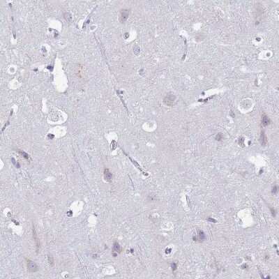 Immunohistochemistry-Paraffin: CD35 Antibody [NBP2-13871]