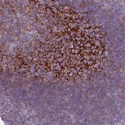 Immunohistochemistry-Paraffin: CD35 Antibody [NBP2-13872]