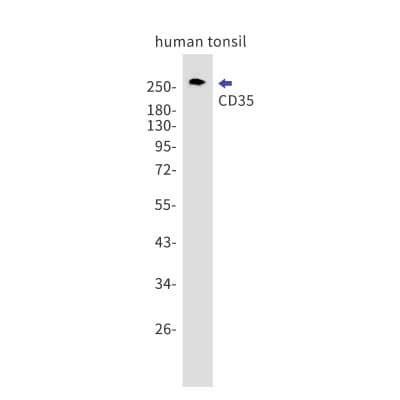 Western Blot: CD35 Antibody (S06-6D1) [NBP3-19598]