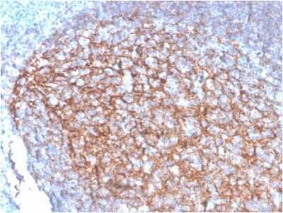 Immunohistochemistry-Paraffin: CD35 Antibody (SPM554) - Azide and BSA Free [NBP2-34796]