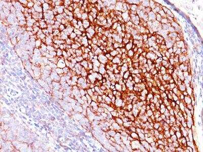 Immunohistochemistry-Paraffin: CD35 Antibody (SPM554) [NBP2-32821]
