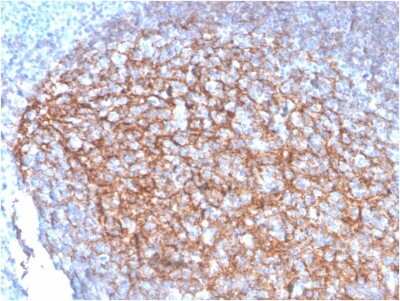 Immunohistochemistry-Paraffin: CD35 Antibody (SPM554) [NBP2-32821]