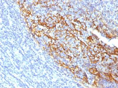 Immunohistochemistry-Paraffin: CD35 Antibody (To5) - Azide and BSA Free [NBP3-08279]