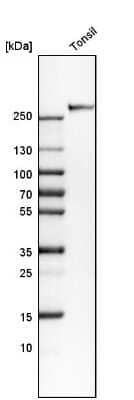 Western Blot: CD35 Antibody [NBP2-13872]