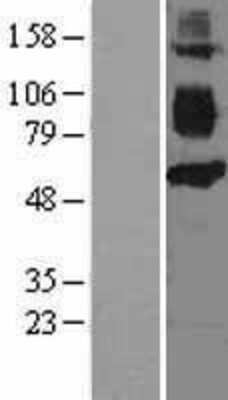 Western Blot: CD36 Overexpression Lysate [NBL1-08939]