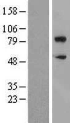 Western Blot: CD36 Overexpression Lysate [NBL1-08940]