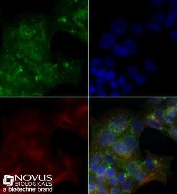 Immunocytochemistry/ Immunofluorescence: CD36 Antibody (1283D) - Azide and BSA Free [NBP2-80644]