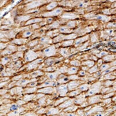 Immunohistochemistry-Paraffin: CD36 Antibody (1283D) - Azide and BSA Free [NBP2-80644]