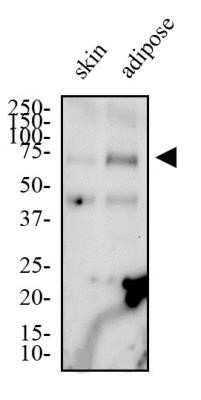 Western Blot: CD36 Antibody (1283D)Azide and BSA Free [NBP2-80644]