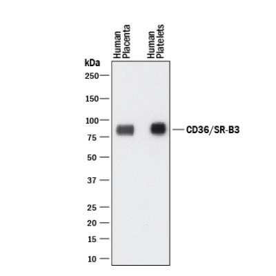 Western Blot: CD36 Antibody (1283D)Azide and BSA Free [NBP2-80644]