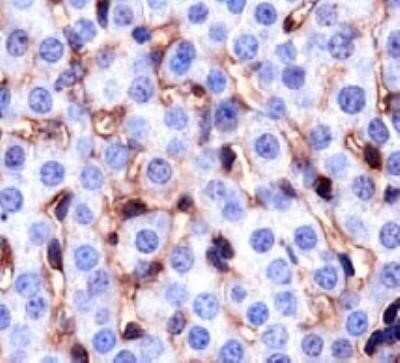 Immunohistochemistry: CD36 Antibody (D-2712) - Azide and BSA Free [NBP2-80643]