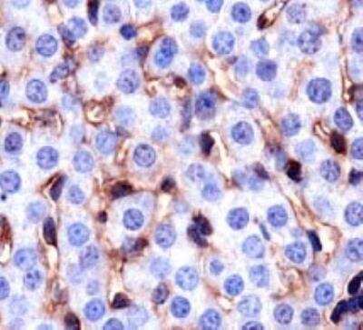 Immunohistochemistry: CD36 Antibody (D-2712) - BSA Free [NB110-59724]