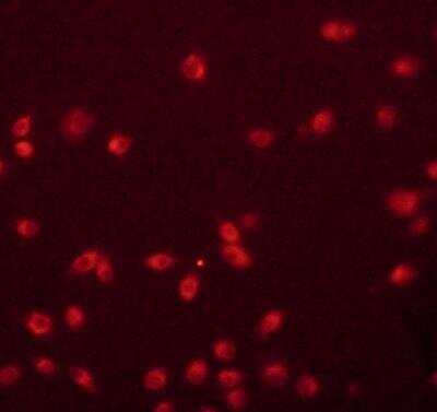 Immunocytochemistry/ Immunofluorescence: CD36 Antibody - BSA Free [NB400-144]