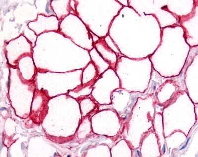 Immunohistochemistry-Paraffin: CD36 Antibody - BSA Free [NB400-144]