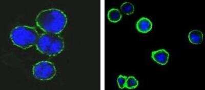 Immunocytochemistry/ Immunofluorescence: CD37 Antibody (2B8) - BSA Free [NBP1-28869]