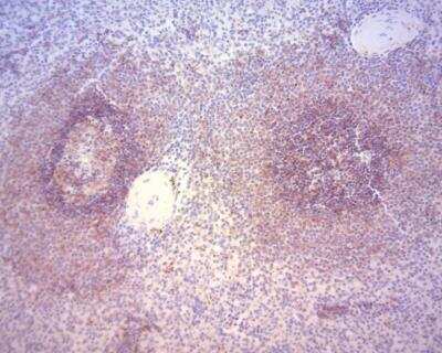 Immunohistochemistry-Paraffin: CD37 Antibody (2B8) - BSA Free [NBP1-28869]