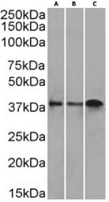 Western Blot: CD37 Antibody (IPO-24 (ZC37-24))ChimericAzide and BSA Free [NBP3-12074]