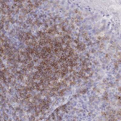 Immunohistochemistry-Paraffin: CD37 Antibody [NBP2-33969]