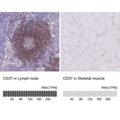 Immunohistochemistry-Paraffin: CD37 Antibody [NBP2-33969]