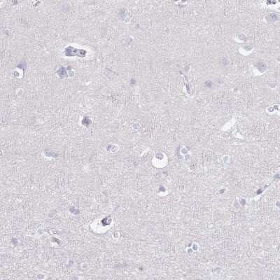 Immunohistochemistry-Paraffin: CD37 Antibody [NBP2-33969]