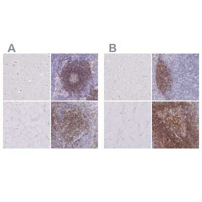 Immunohistochemistry-Paraffin: CD37 Antibody [NBP2-33969]