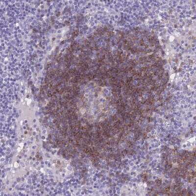 Immunohistochemistry-Paraffin: CD37 Antibody [NBP2-33969]