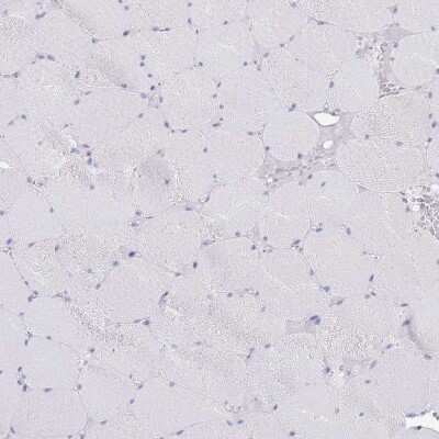 Immunohistochemistry-Paraffin: CD37 Antibody [NBP2-33969]