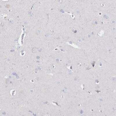 Immunohistochemistry-Paraffin: CD37 Antibody [NBP2-33970]