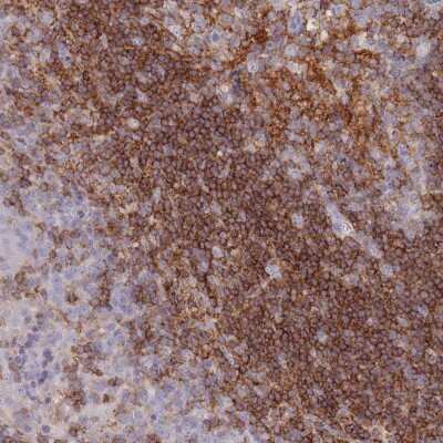 Immunohistochemistry-Paraffin: CD37 Antibody [NBP2-33970]