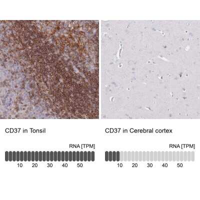 Immunohistochemistry-Paraffin: CD37 Antibody [NBP2-33970]