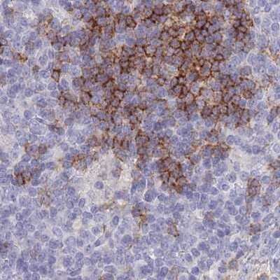 Immunohistochemistry-Paraffin: CD37 Antibody [NBP2-33970]