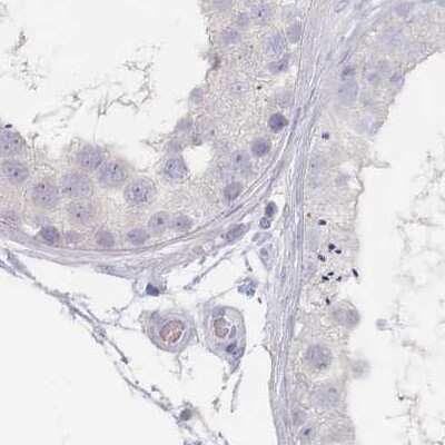 Immunohistochemistry-Paraffin: CD37 Antibody [NBP2-33970]