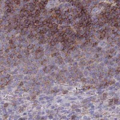 Immunohistochemistry-Paraffin: CD37 Antibody [NBP2-33970]