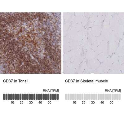 Immunohistochemistry-Paraffin: CD37 Antibody [NBP2-33970]