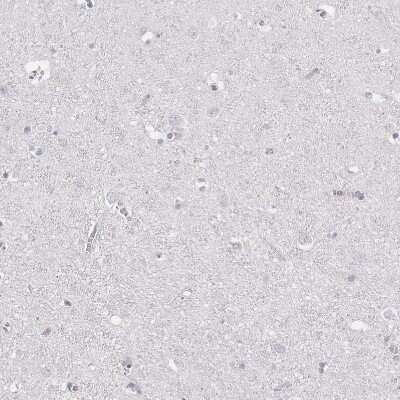 Immunohistochemistry-Paraffin: CD37 Antibody [NBP2-33970]
