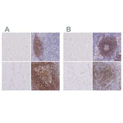 Immunohistochemistry-Paraffin: CD37 Antibody [NBP2-33970]