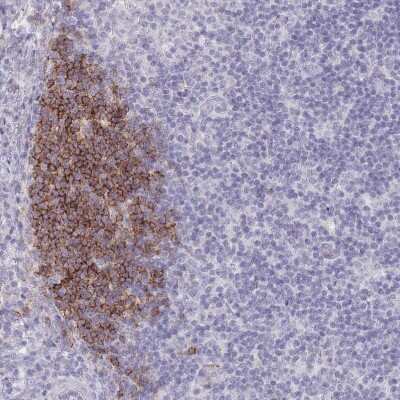 Immunohistochemistry-Paraffin: CD37 Antibody [NBP2-33970]