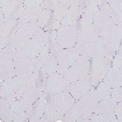 Immunohistochemistry-Paraffin: CD37 Antibody [NBP2-33970]