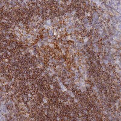 Immunohistochemistry-Paraffin: CD37 Antibody [NBP2-33970]