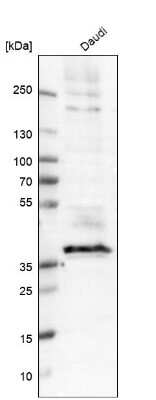 Western Blot: CD37 Antibody [NBP2-33969]
