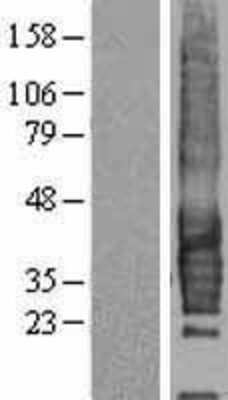 Western Blot: CD37 Overexpression Lysate [NBL1-08941]