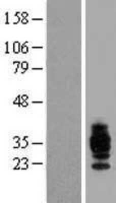 Western Blot: CD37 Overexpression Lysate [NBP2-08542]