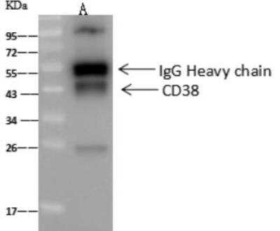 Immunoprecipitation: CD38 Antibody (003) [NBP2-89658]