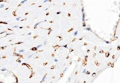 Immunohistochemistry-Paraffin: CD38 Antibody (32) [NBP2-90470]