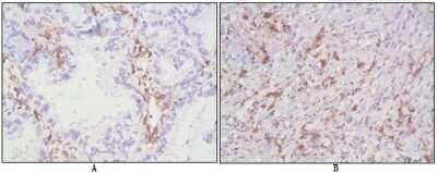 Immunohistochemistry-Paraffin: CD38 Antibody (6E12D) - BSA Free [NBP1-47462]