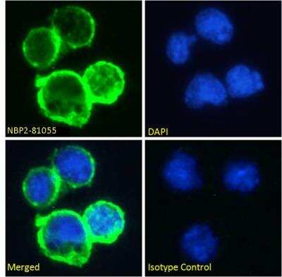 Immunocytochemistry/ Immunofluorescence: CD38 Antibody (AT13/5) - Chimeric - Azide and BSA Free [NBP2-81055]